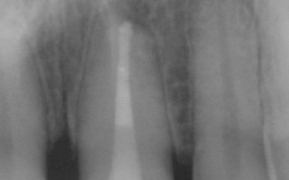 Obrázek - 1537348433case4c.jpg