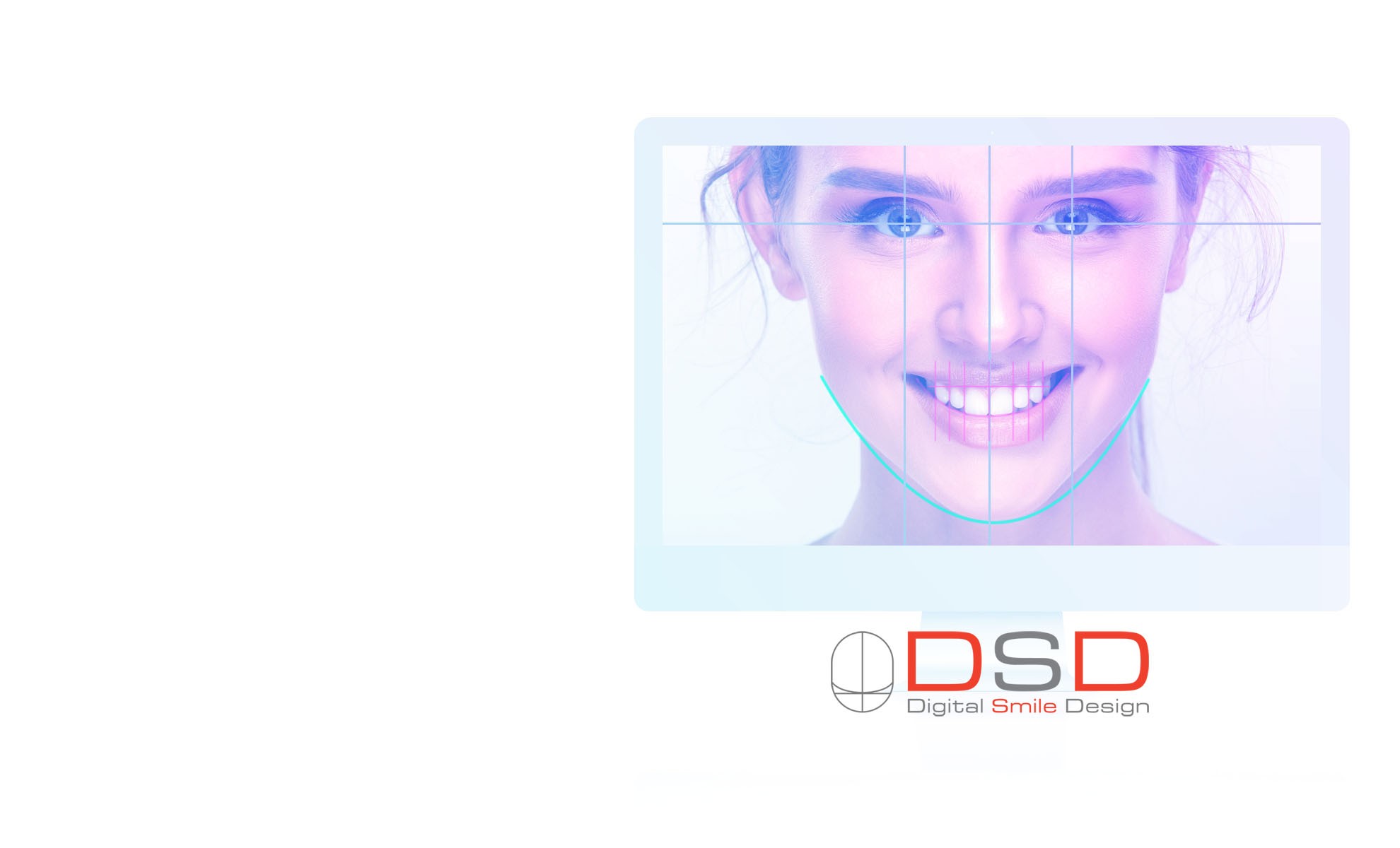 Digital Smile Design